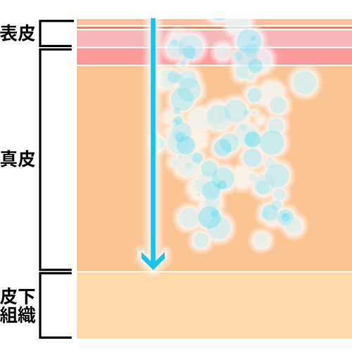 エレクトロポレーション(電気穿孔法)