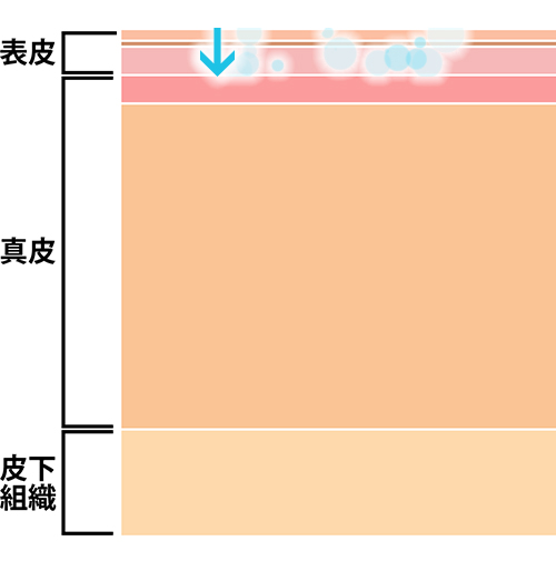 イオン導入