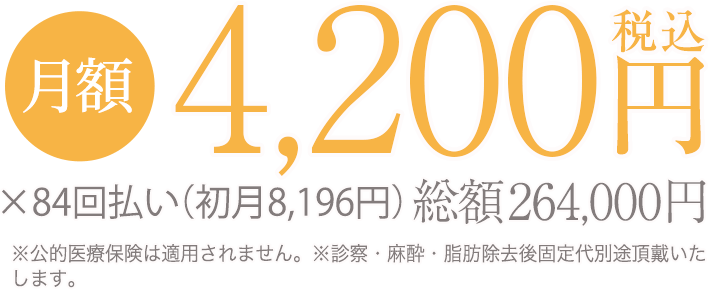 モニター価格と通常価格