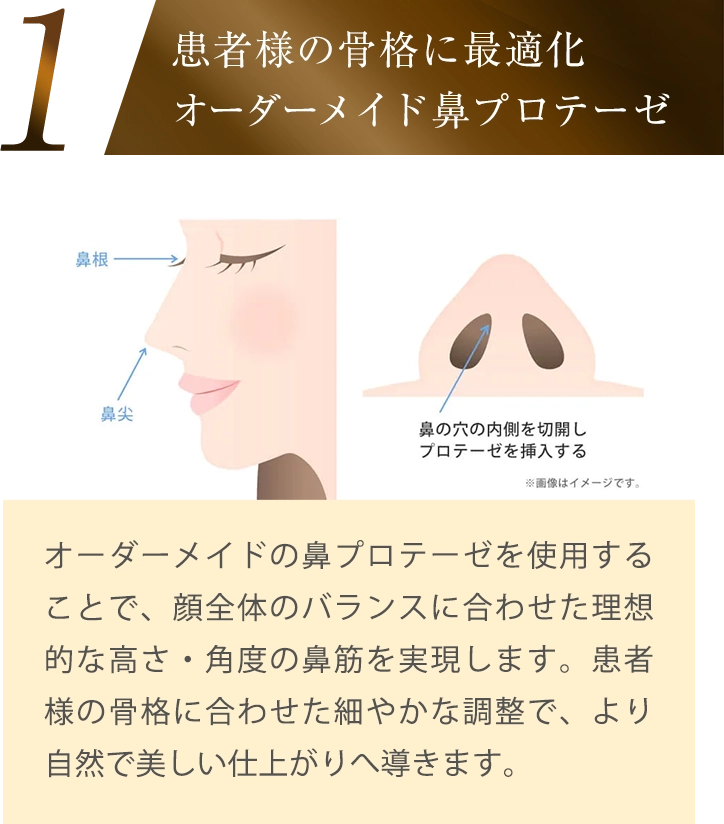 患者様の骨格に最適化 オーダーメイド鼻プロテーゼ