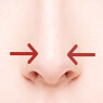 鼻尖形成（オープン法・クローズ法）