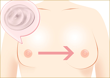ヒアルロン酸注入豊胸術のイメージ