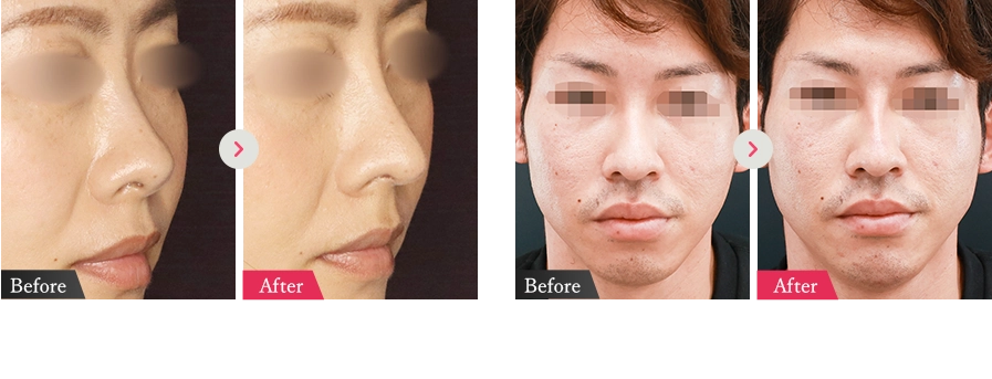 症例写真