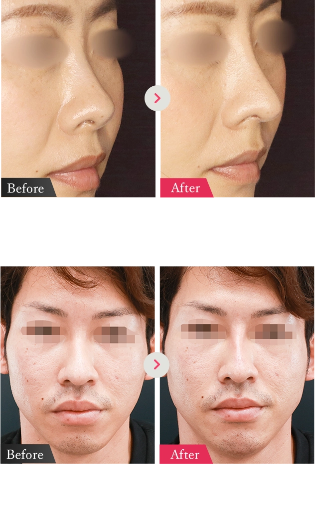 症例写真