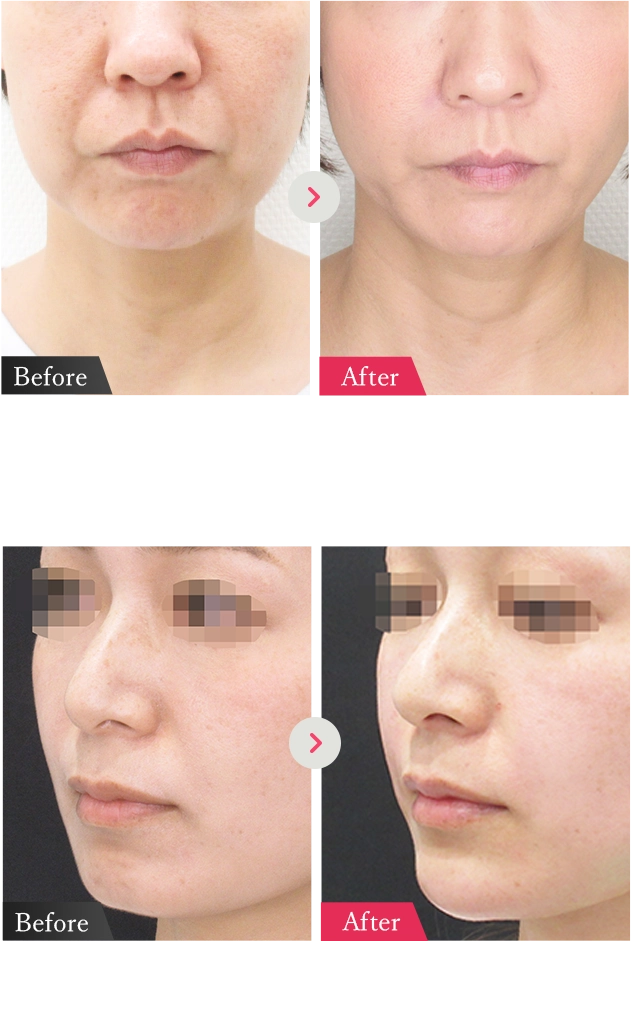 症例写真