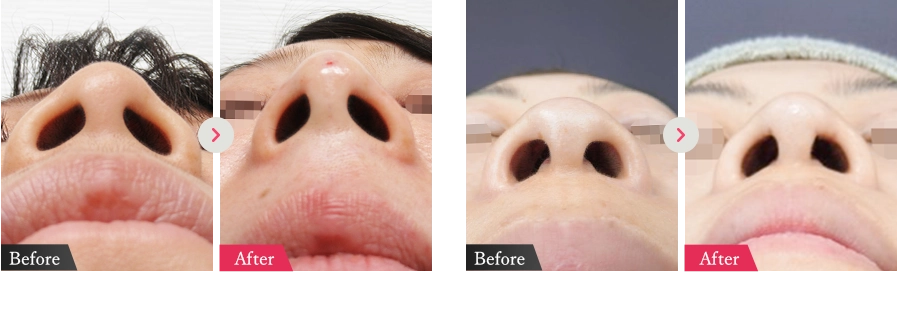 症例写真