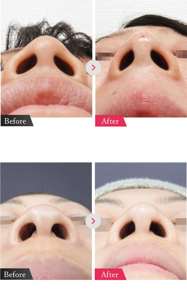 症例写真