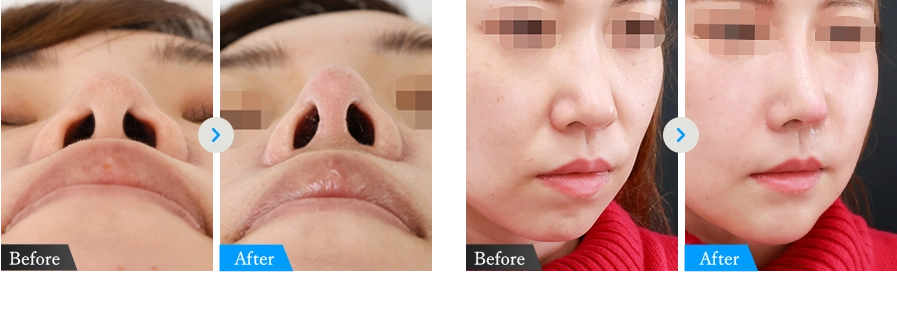 症例写真