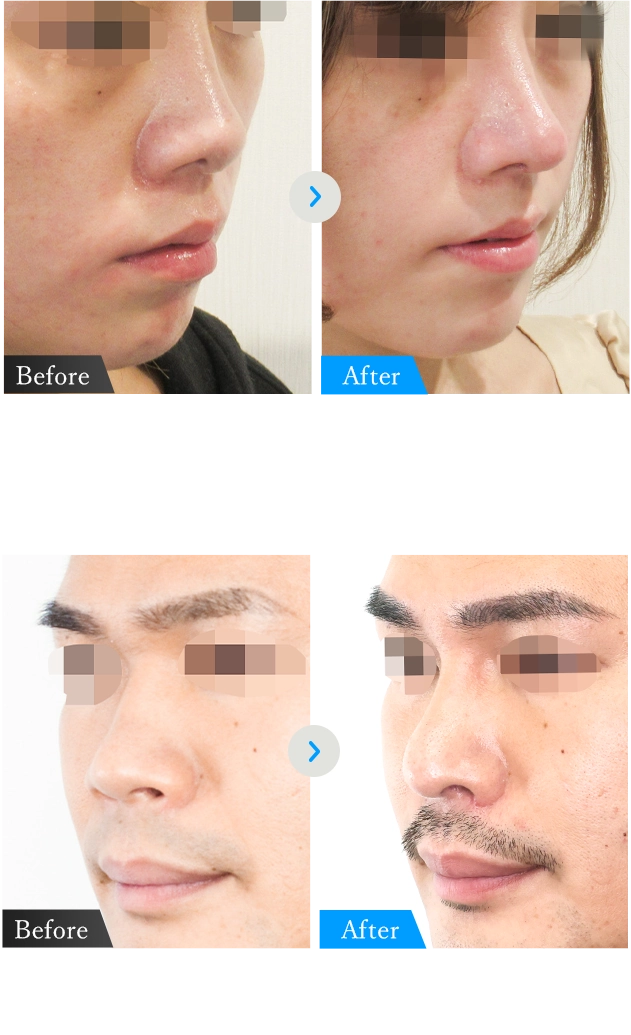 症例写真