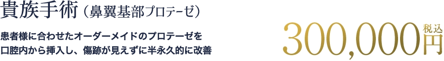貴族手術（鼻翼基部プロテーゼ）の料金