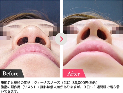症例写真
