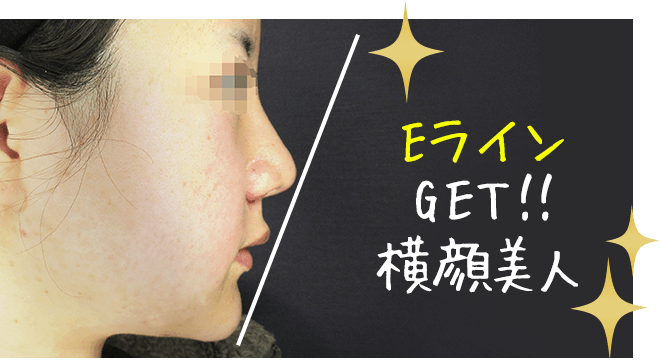 EラインGET‼横顔美人