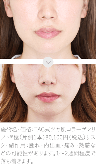 症例写真