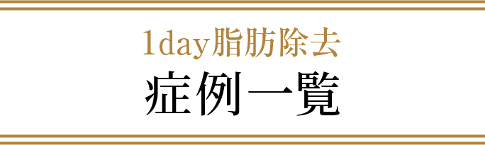 1day脂肪除去 症例一覧