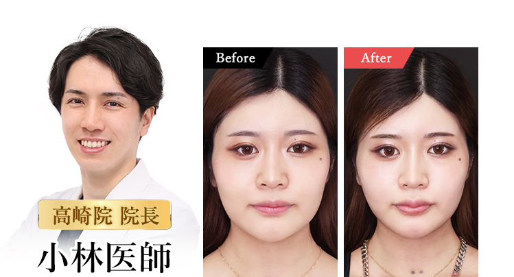 高崎院 院長 小林医師