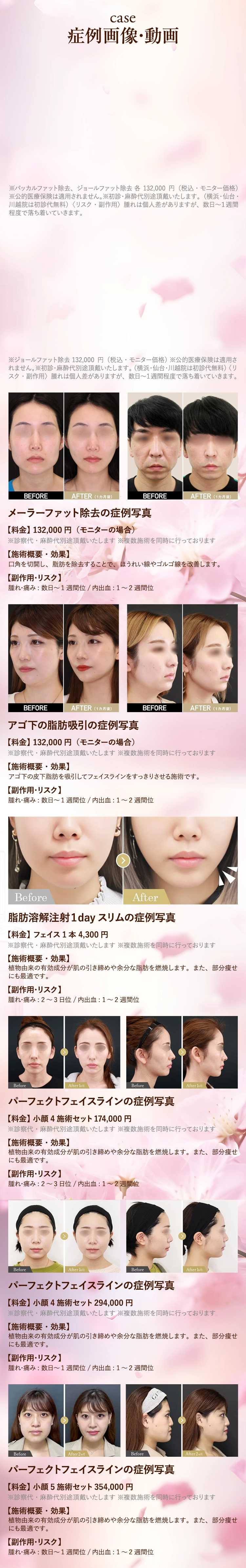 症例写真