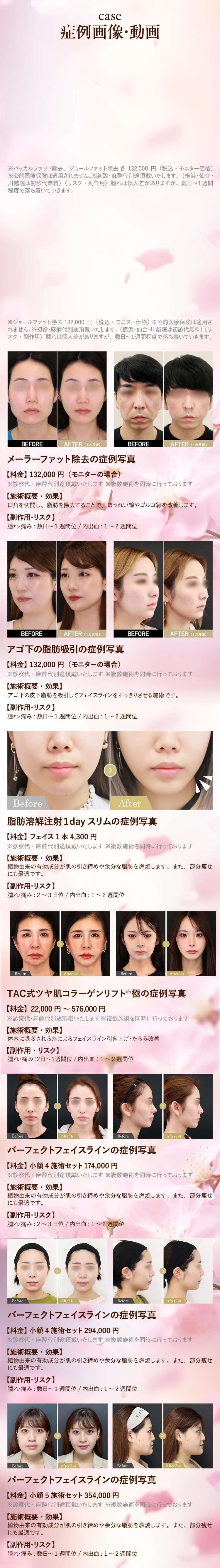 症例写真