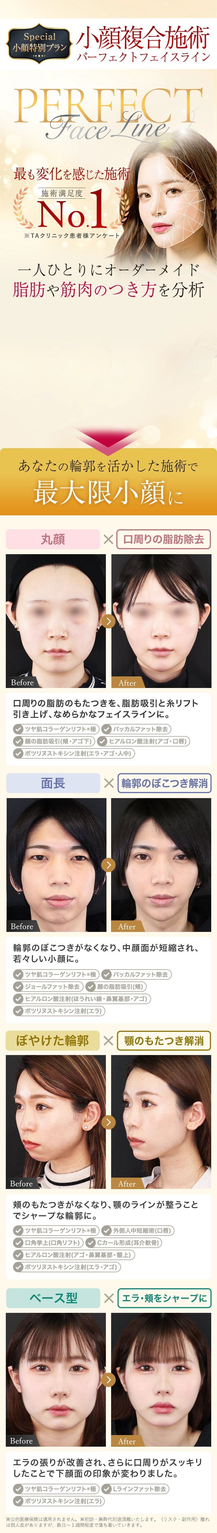 特別プラン