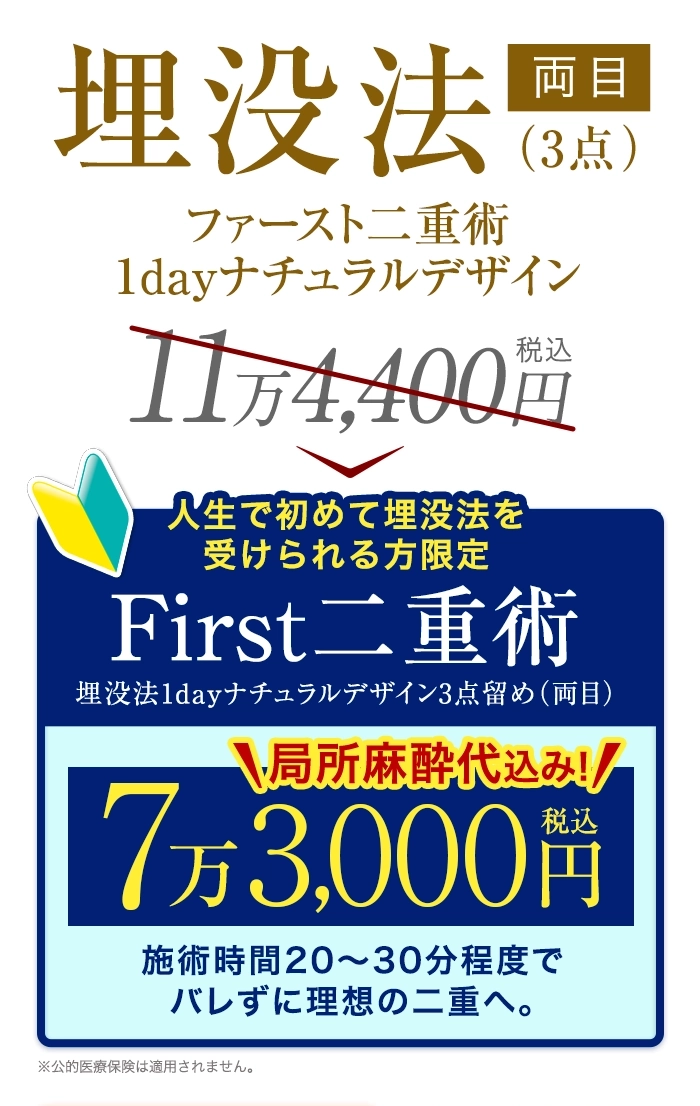 埋没法スタンダードクイック