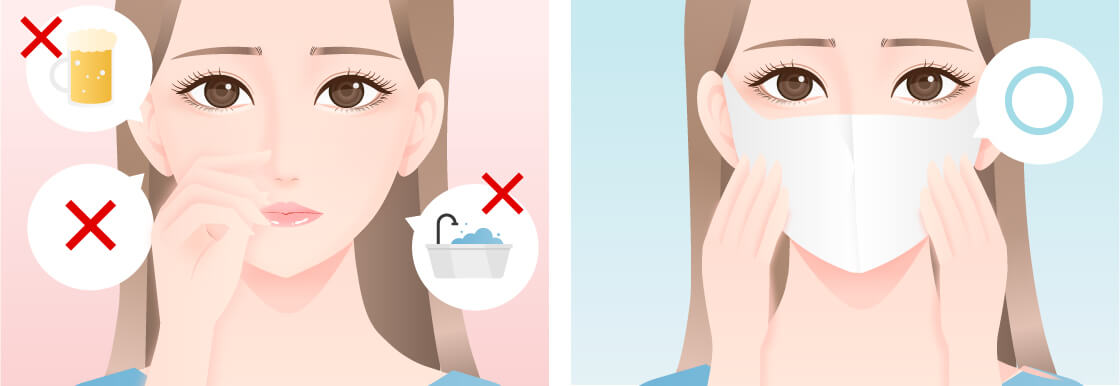 【鼻整形・小鼻整形】隆鼻術プロテーゼ、TAC式鼻翼縮小術（小鼻縮小）、鼻中隔延長術のダウンタイムの過ごし方