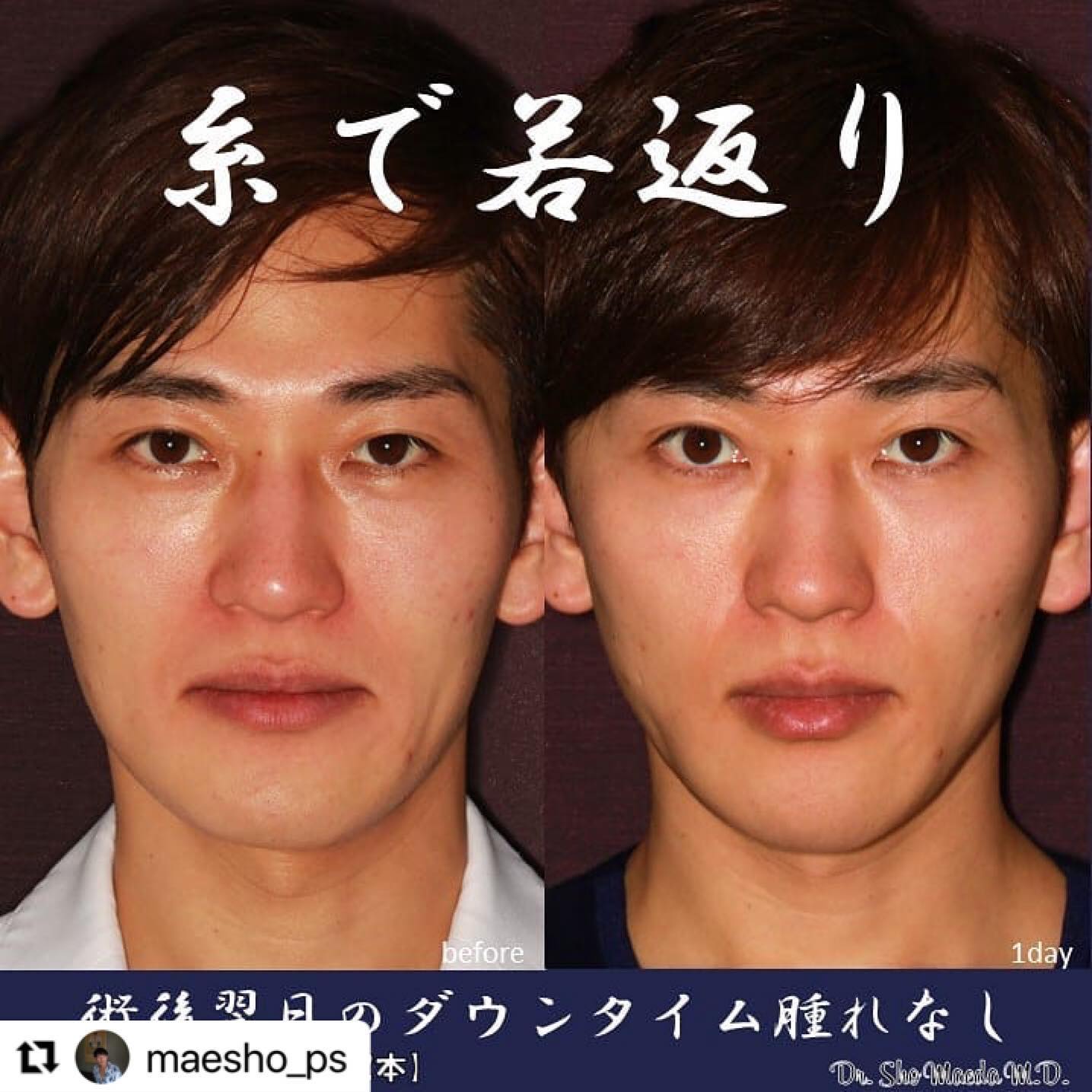 福岡の男性美容整形 メンズtaクリニックがモテる男をトータルプロデュース イケメン二重 美肌 ダイエット 鼻整形の名医 美容外科
