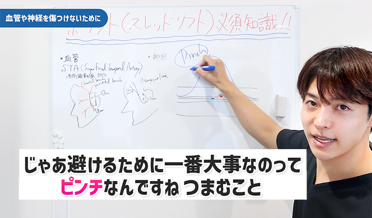 糸リフトでは内出血も腫れも少ないのは解剖学的に神経を避けているから