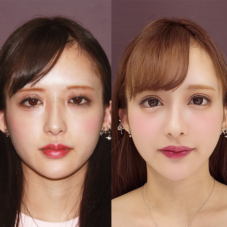 公式 新宿taクリニック 東京 新宿の美容整形 美容外科 美容皮膚科