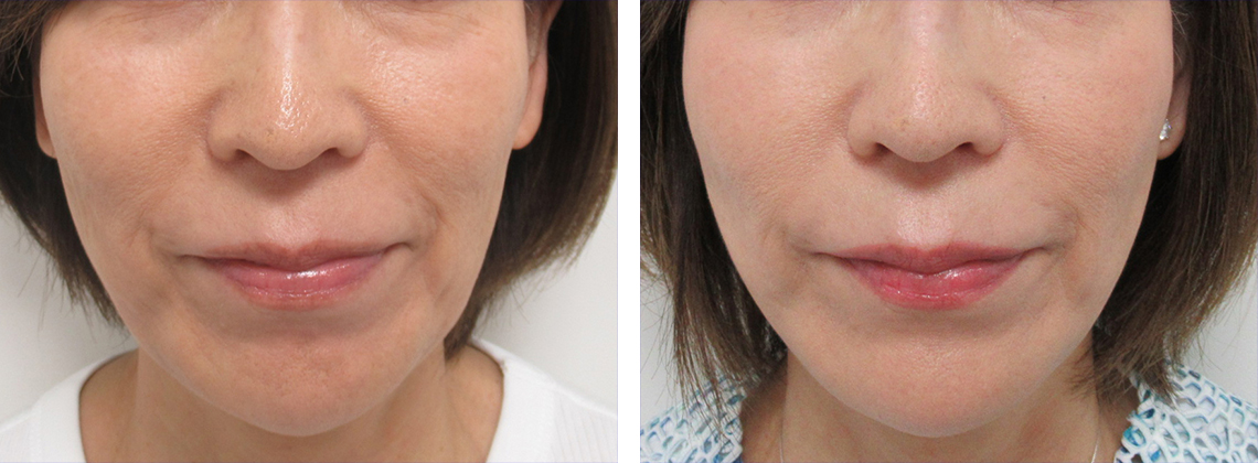 徐々に馴染んでいきます