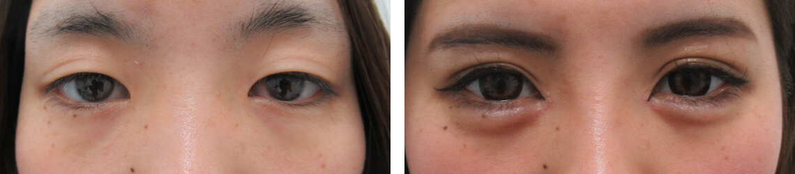 目の黄金比を整える