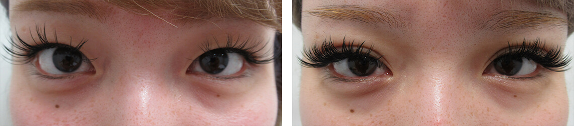 まつげエクステが映える二重