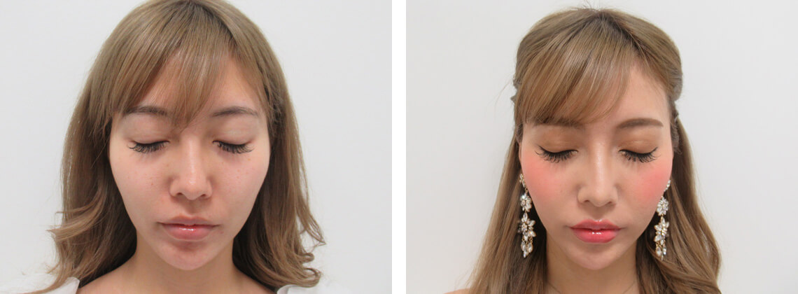 吉川ちえ様がウルトラセル３層モードを体験