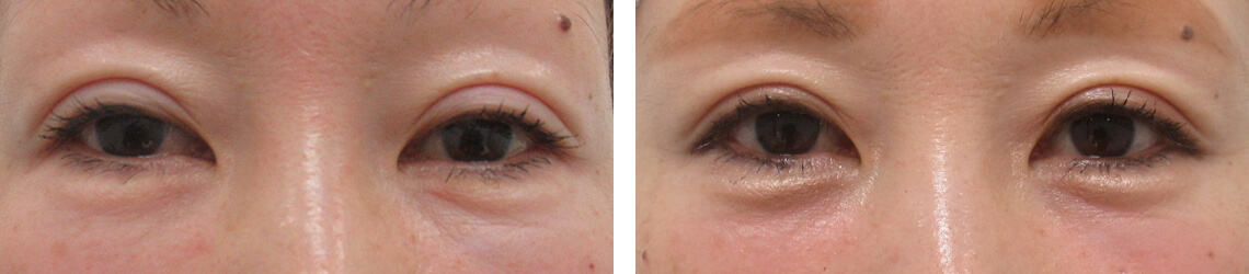 ナチュラル系タレ目