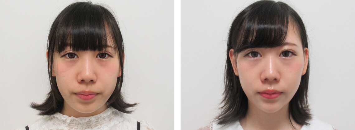 全顔モニター様が可愛い系から綺麗系に