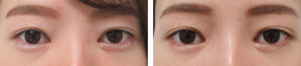 自然なグラマラスライン希望