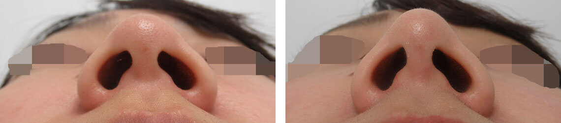 ツンとした鼻先に