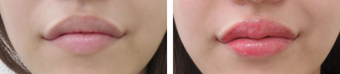 元のくちびるのラインを生かして