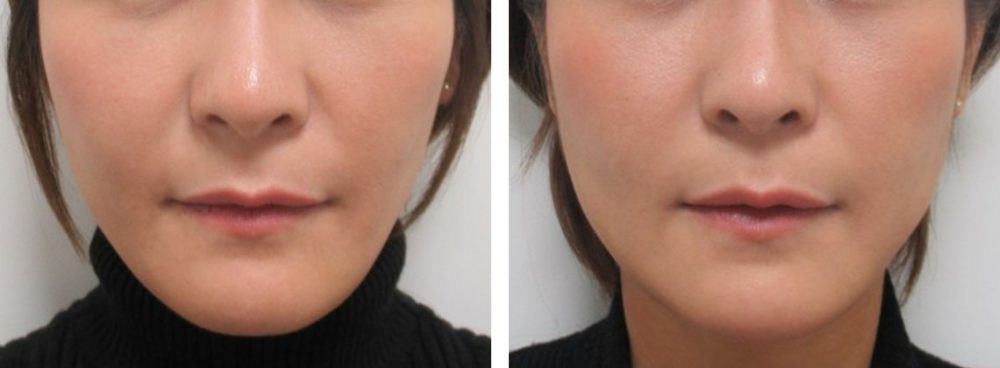 お肌のトーンも上がります