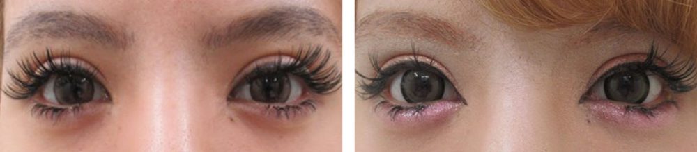 グラマラスライン形成で横幅も大きく