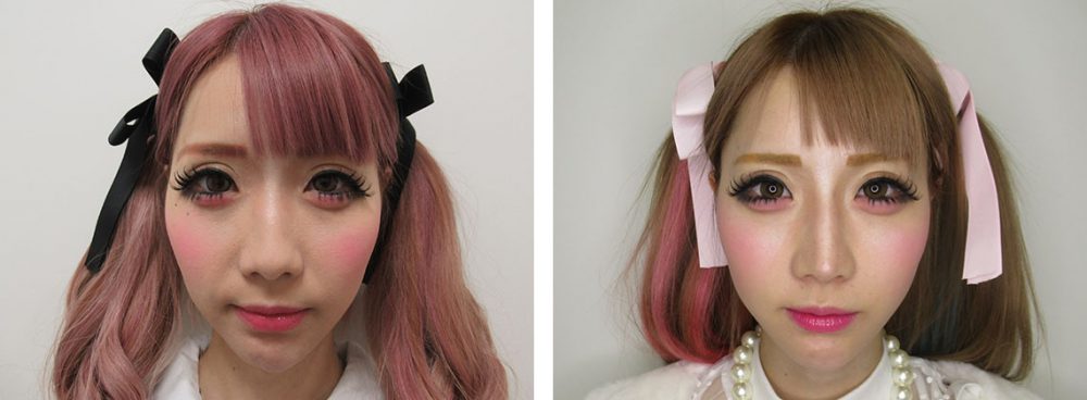 ちいめろ様の輪郭１ヵ月経過です