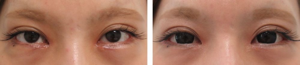 目尻の位置を変えて優しい印象に