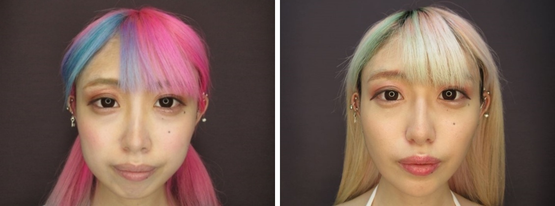 顔も鼻もコンパクトに