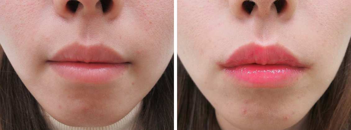 口角が上がり可愛らしい口元に