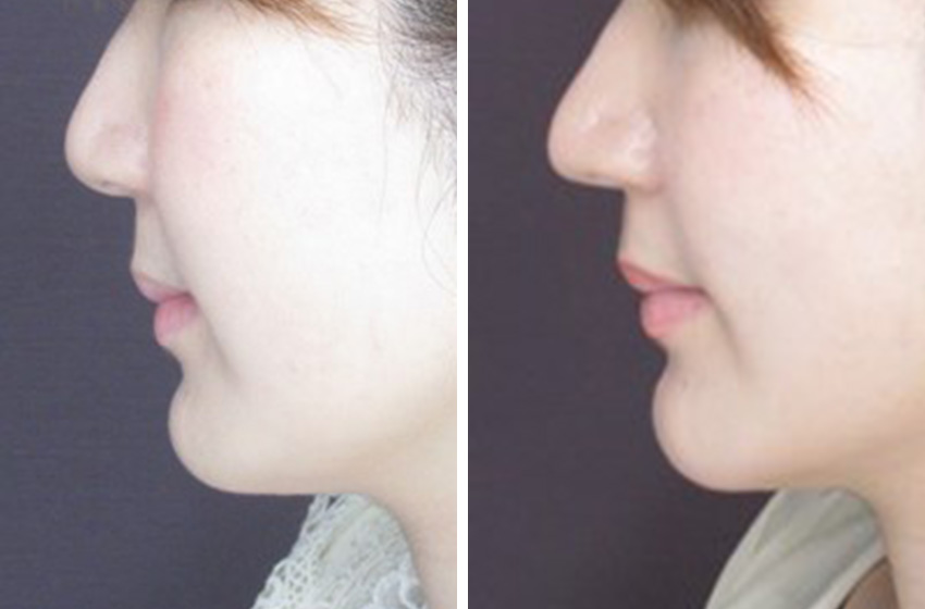 自然な感じで鼻先に変化を出す