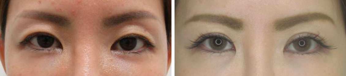 1dayナチュラルデザインオプティマルで印象的なお目元へ