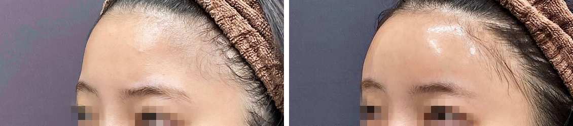 触りたくなるオルチャンデコ