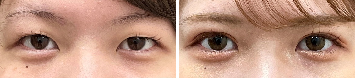 コスメリングで自然にパッチリ大きな目元