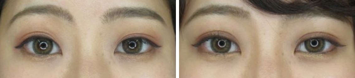 埋没法でメイク映えするお目元に