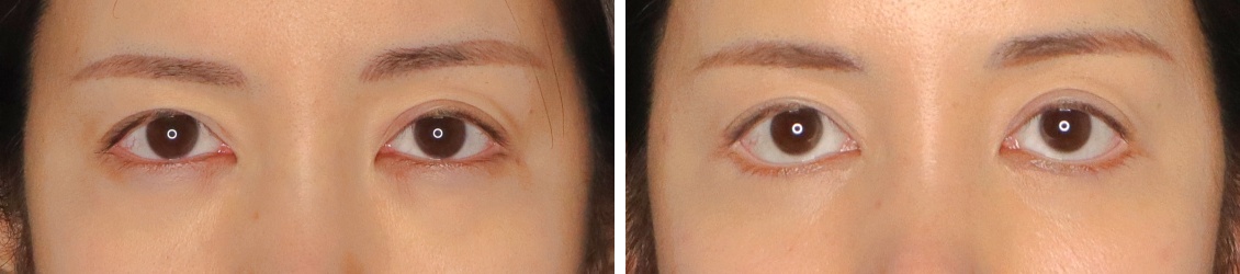 グラマラスラインで切れ長目元を優しい印象に