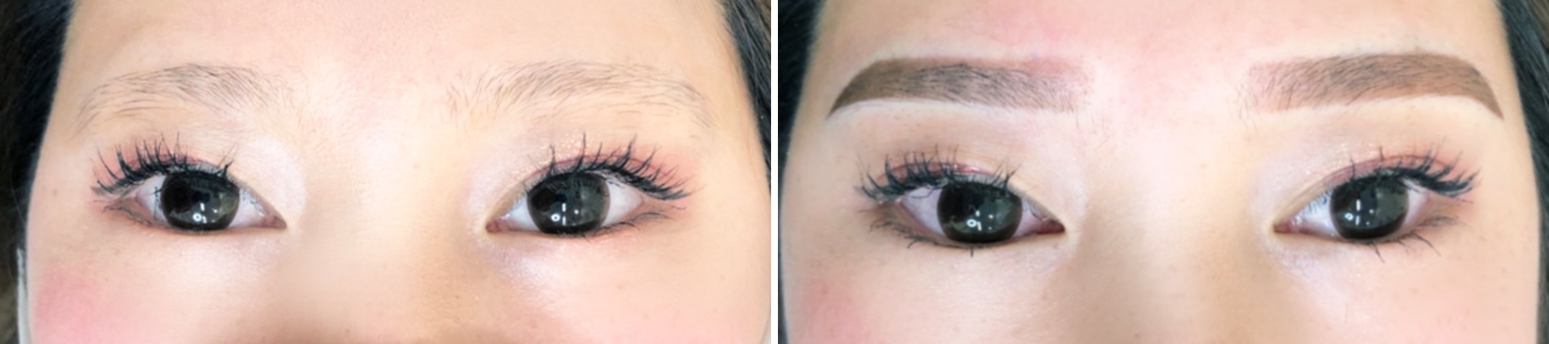 TACメディカルアートメイク（眉・アイライン・リップ）の症例写真 施術前後 直後