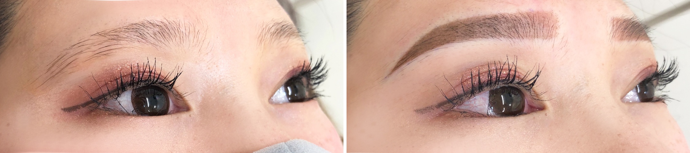 TACメディカルアートメイク（眉・アイライン・リップ）の症例写真 施術前後 直後